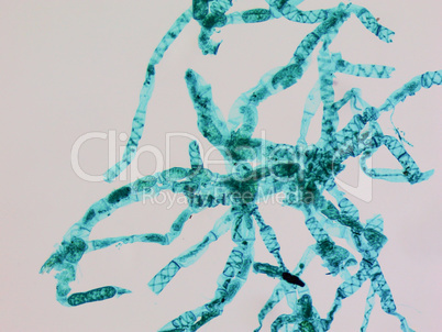 Spirogyra micrograph