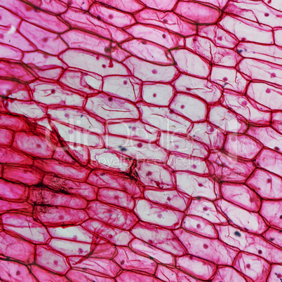 Onion epidermus micrograph