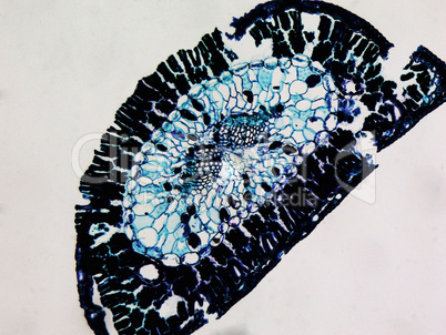 Pine leaf micrograph