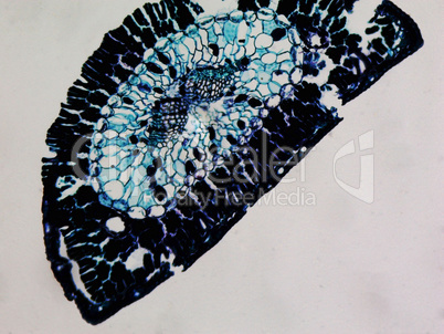 Pine leaf micrograph