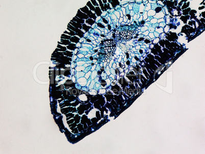 Pine leaf micrograph