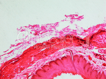 Epithelium micrograph