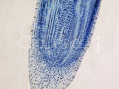 Cells mitosis micrograph