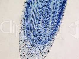 Cells mitosis micrograph