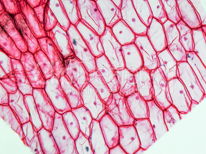 Onion epidermus micrograph