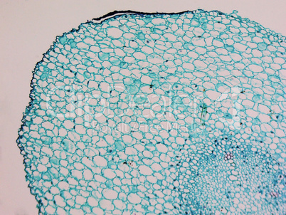 Vicia faba root micrograph