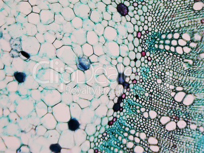 Cotton stem micrograph