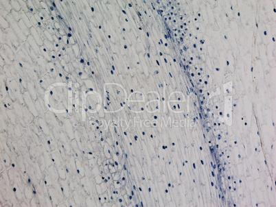 Corn root tip micrograph Corn root tip micrograph