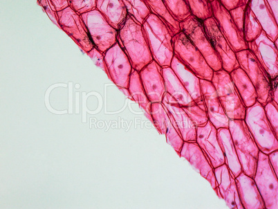 Onion epidermus micrograph