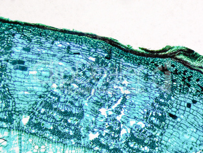 Tilia stem micrograph