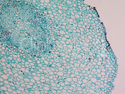 Vicia faba root micrograph