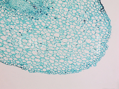 Vicia faba root micrograph