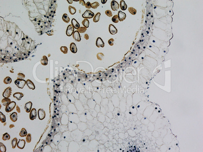 Lily anther micrograph Lily anther micrograph