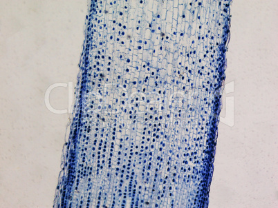 Cells mitosis micrograph