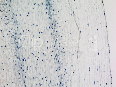 Corn root tip micrograph