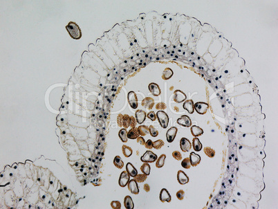 Lily anther micrograph