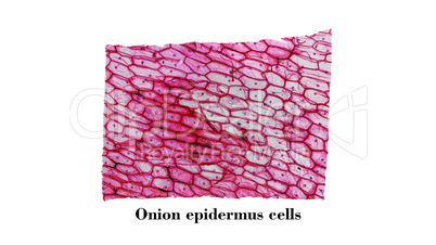 Onion epidermus micrograph