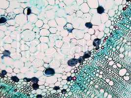 Cotton stem micrograph