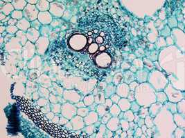 Cucurbita stem micrograph