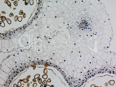 Lily anther micrograph Lily anther micrograph