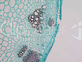 Heliansthus stem micrograph