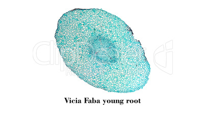 Vicia faba root micrograph