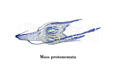 Moss protonemata micrograph