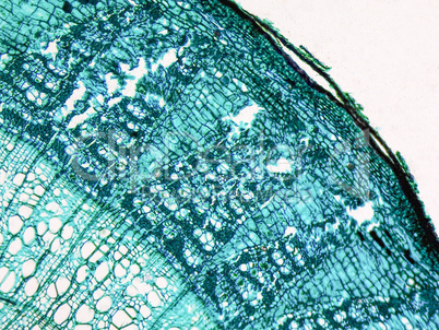 Tilia stem micrograph