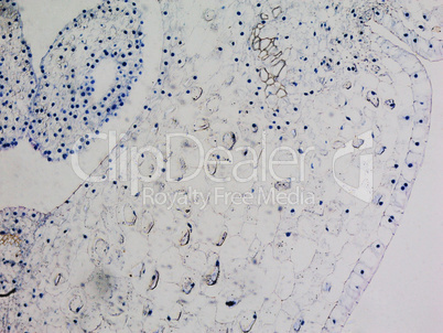 Lily ovary micrograph Lily ovary micrograph