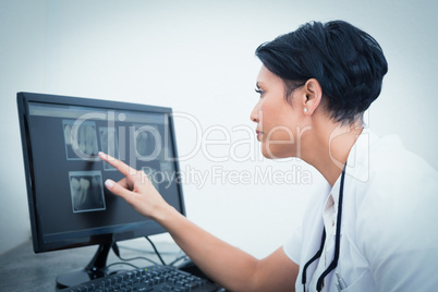 Female dentist looking at x-ray on computer