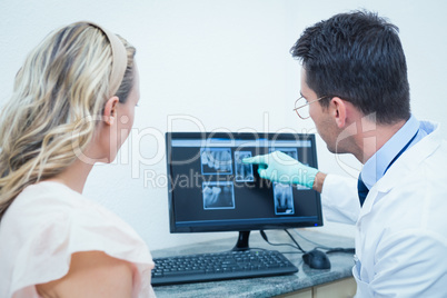 Dentist showing woman her mouth x-ray on computer