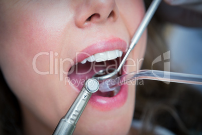 Close up of woman having her teeth examined