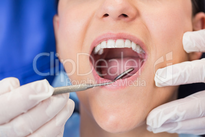 Dentist examining a patient with angle mirror