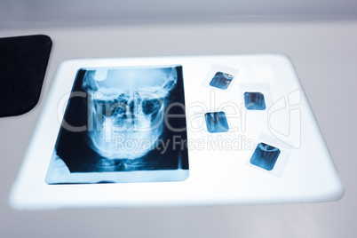 Close up of a x-ray of a human skull on the table