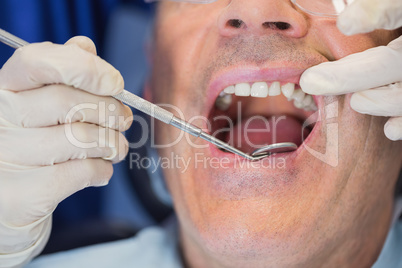 Patient mouth open and dentist examining