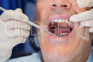 Patient mouth open and dentist examining