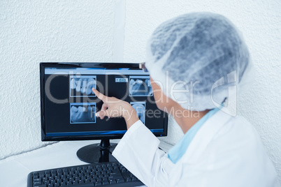 Dentist looking at x-ray on computer