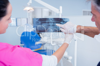 Dentist and assistant examining x-ray together