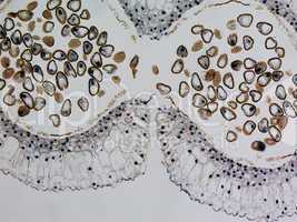 Lily anther micrograph