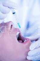 Close up of a patient with mouth open and syringe for injection