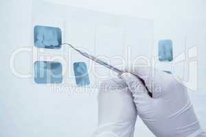 Gloved hand holding dental tool to teeth x-ray