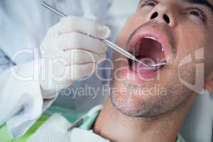 Close up of man having his teeth examined