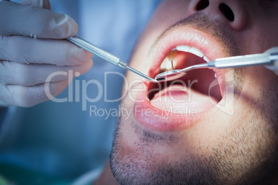 Close up of man having his teeth examined