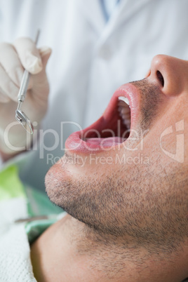 Close up of man having his teeth examined