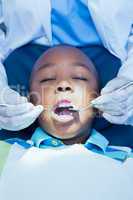 Close up of boy having his teeth examined