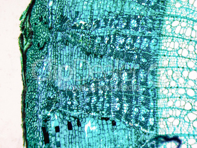 Tilia stem micrograph