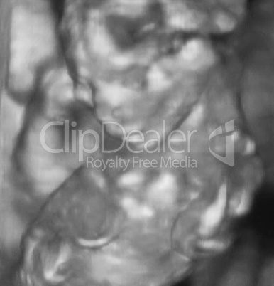 3D Ultrasonography Analysis of a 4th Month Fetus