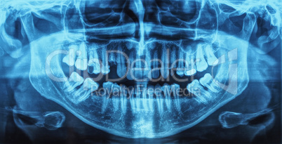 Medical Xray