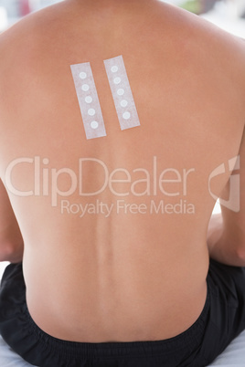 Patient with skin test in his back