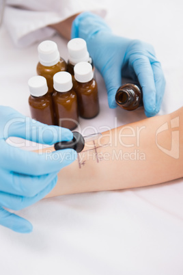 Doctor doing skin prick test at his patient